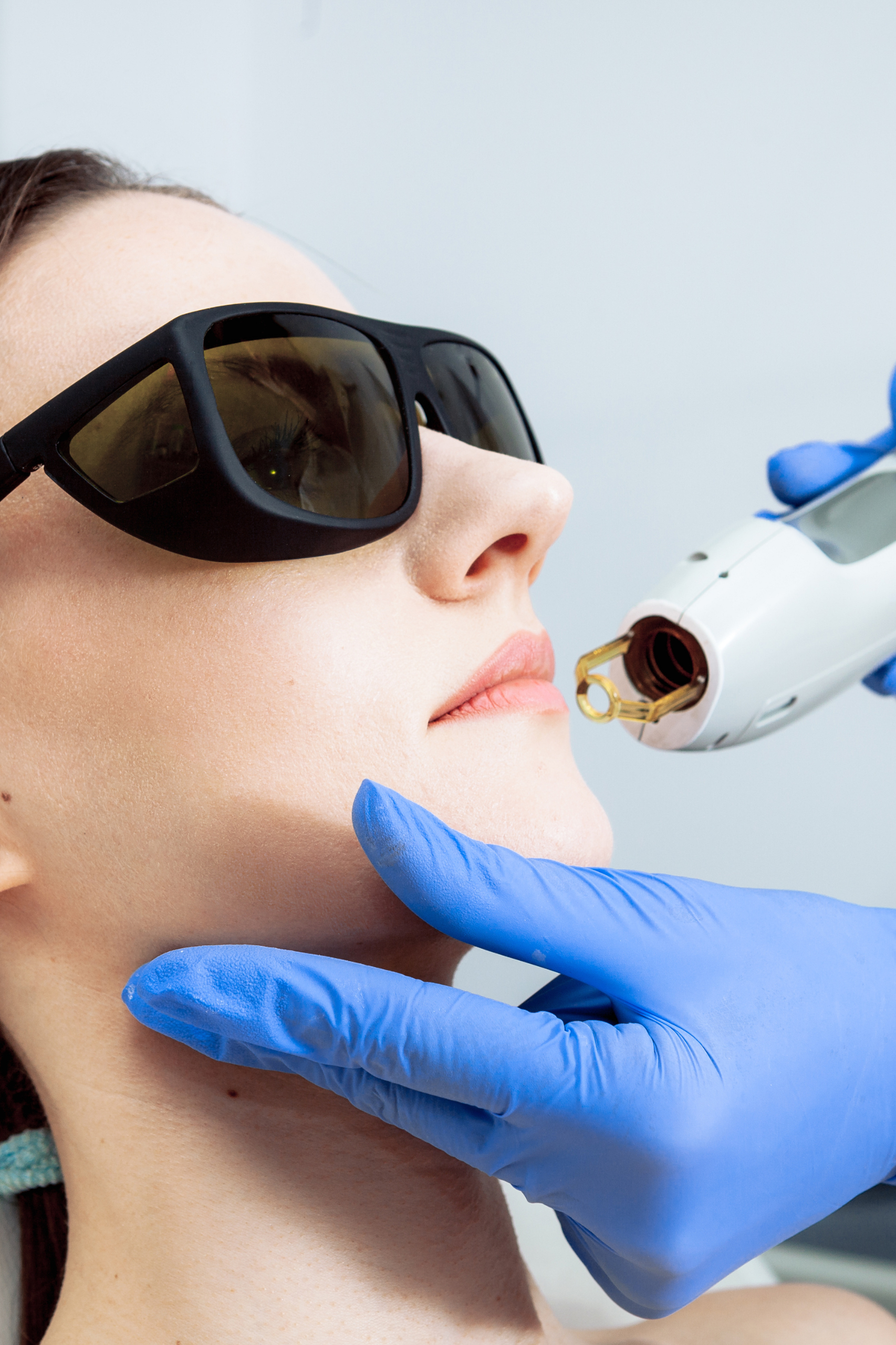 Forfait Epil&rsquo;action Lèvre + Menton