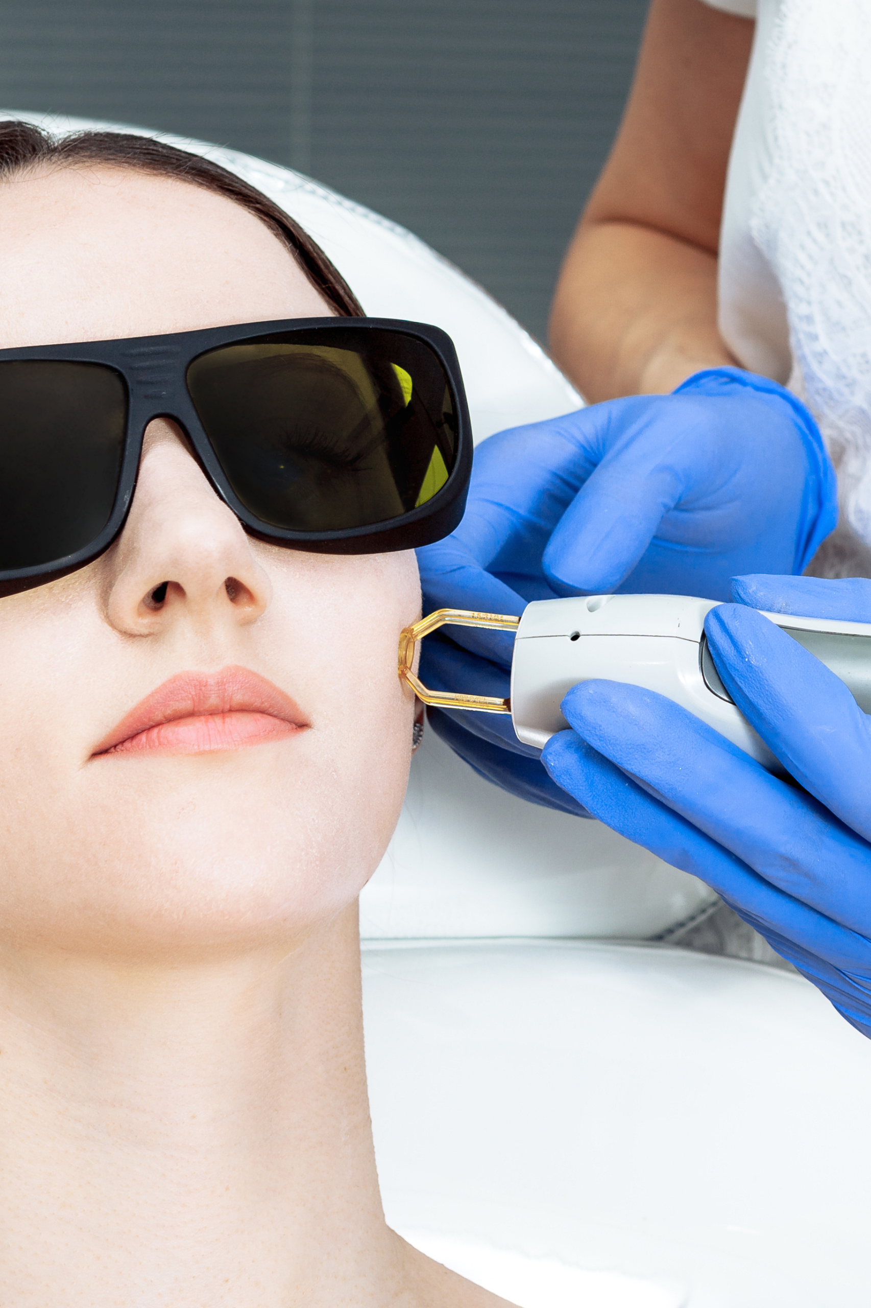 Forfait Epil&rsquo;action Lèvre